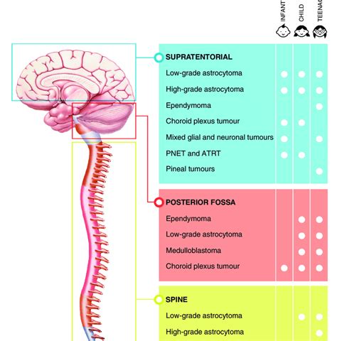 types of brain tumours uk