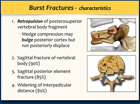 Types Of Burst Fractures