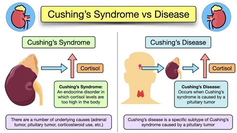 Types Of Cushing S Disease