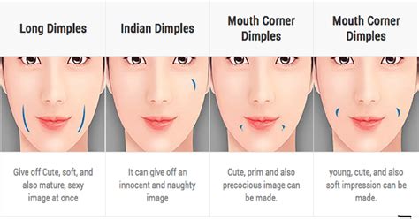 types of dimples