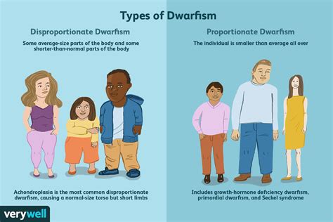 Types Of Dwarfism Chart Dwarfism Impart Differ Genes Greatly