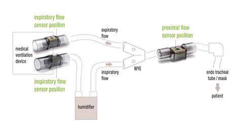 Types Of Flow Sensors In Ventilators