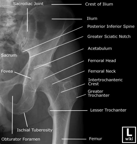 Types Of Hip X Ray Views