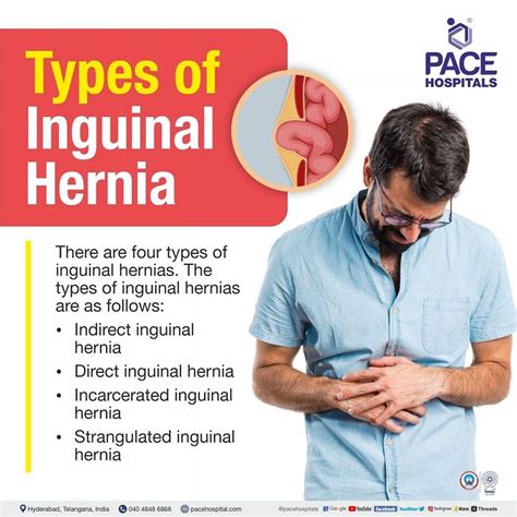 types of inguinal hernia