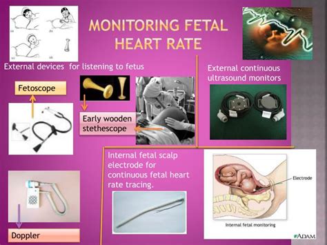Types Of Monitoring During Labor