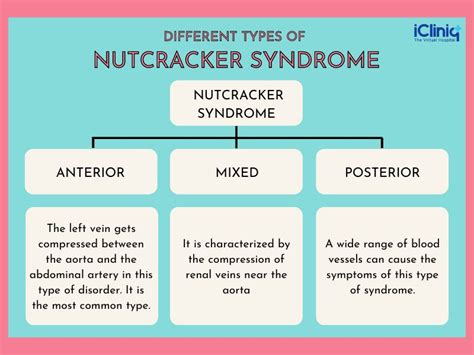 Types Of Nutcracker Syndrome