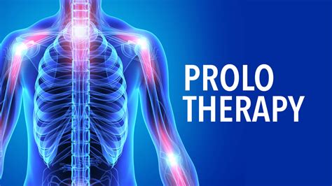 Types Of Prolotherapy