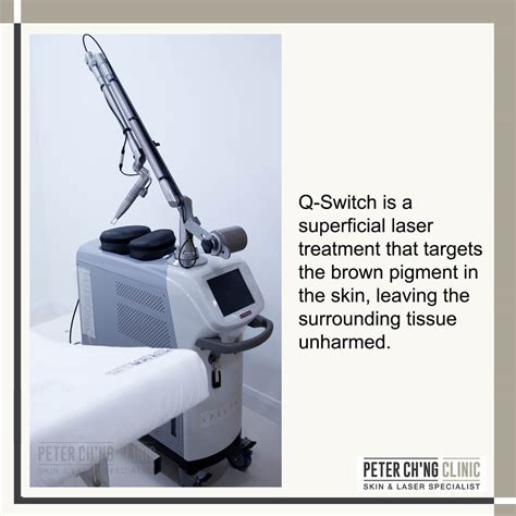 Types Of Q Switch Laser