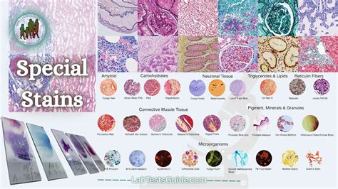 Types Of Special Stains