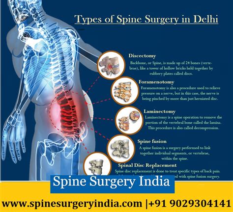 types of spinal surgery