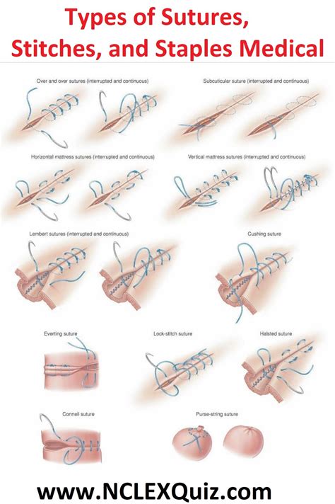 Types Of Sutures Techniques
