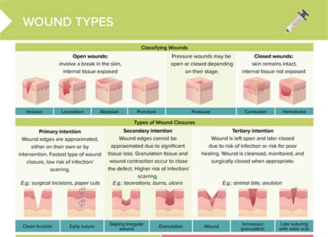 Types Of Wound Cuts