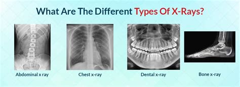 Types Of X Ray Methods