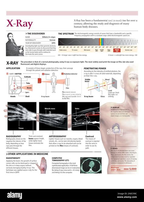Types Of X Ray Procedures
