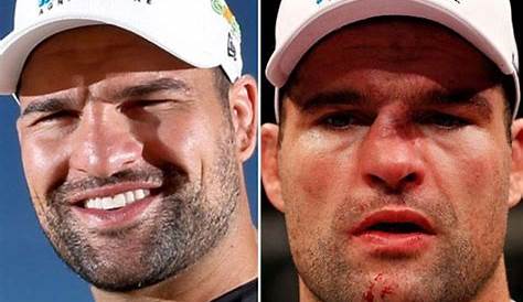 UFC Fighters Before And After A Fight (15 pics)