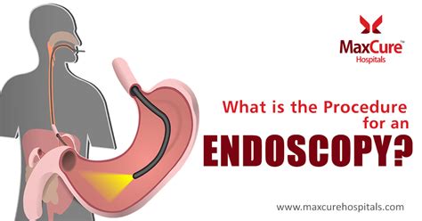 ugi endoscopy test price near me