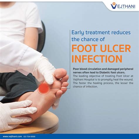 How To Treat Ulcers On Foot: A Comprehensive Guide