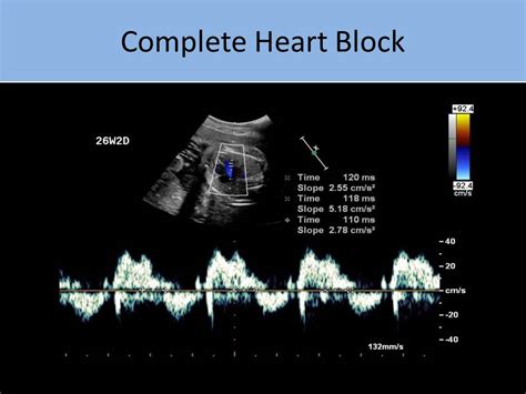 ultrasound registry review fetal echo