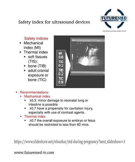 Ultrasound Safety