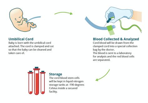 umbilical cord blood bank