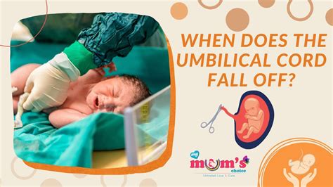 When Does the Umbilical Cord Fall Off After Birth