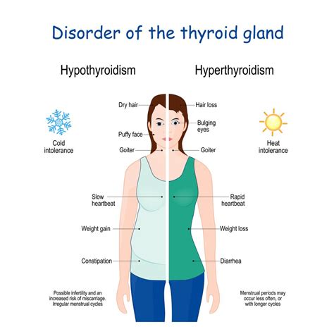 underactive thyroid and panic attacks