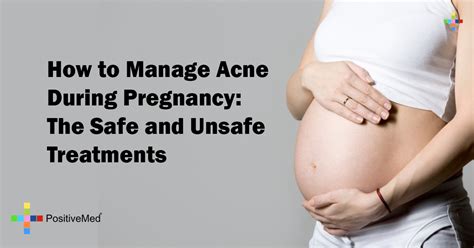 unsafe acne discourse during gestation