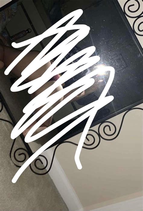 What Healthcare Providers Refuse to Discuss: XXX Chromosome Disorder Revealed!