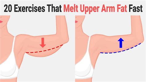 Upper Arm Fat Removal Exercises