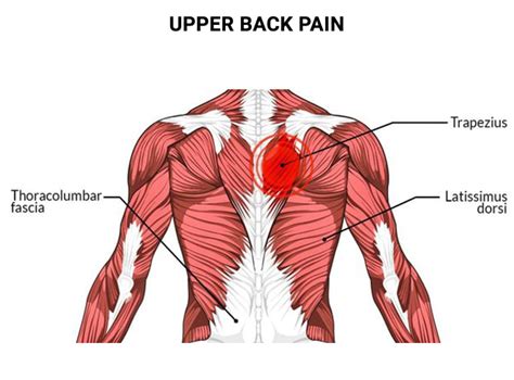 Relieve Upper Back Pain: Effective Solutions and Stretches Inside