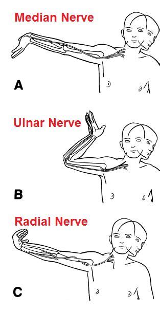 upper limb tension test median nerve