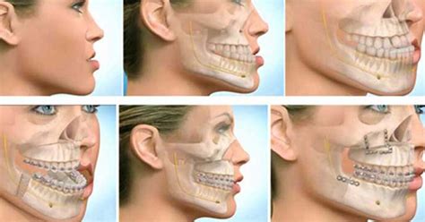 upper west side oral maxillofacial surgery