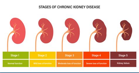 uptodate advanced chronic kidney disease