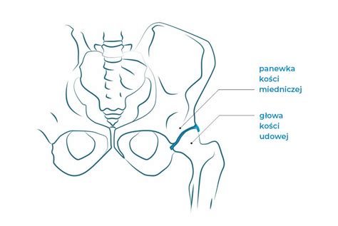 uraz biodra lewego icd 10