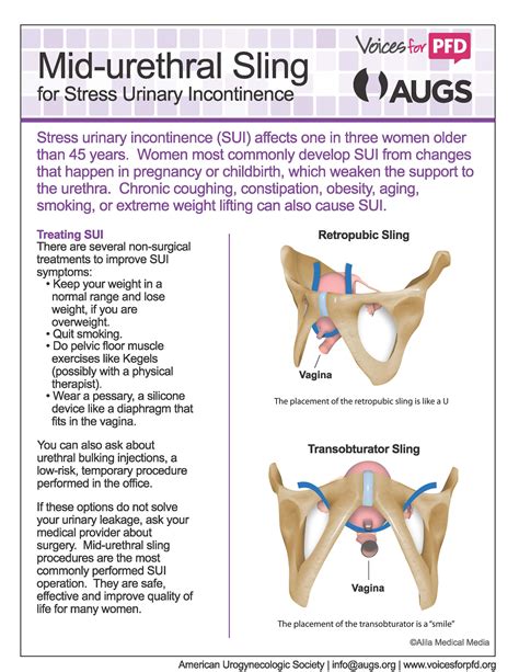 urethral sling procedure for women