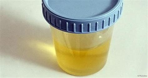 urin