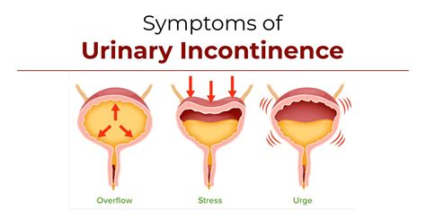 Urinary Incontinence When Drunk