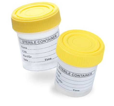 Urine Container Picture