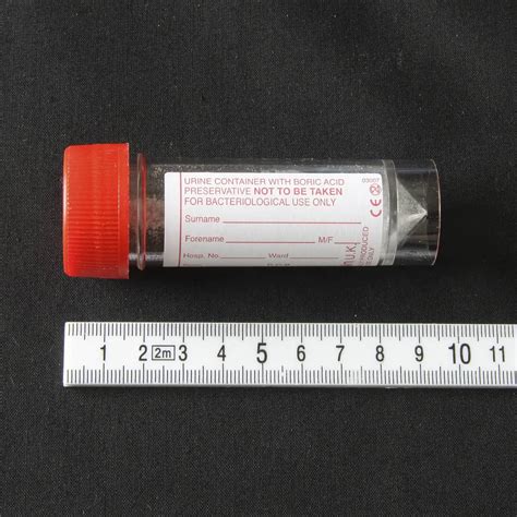 Urine Container With Boric Acid Preservative'