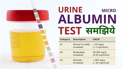 Urine Hs Code