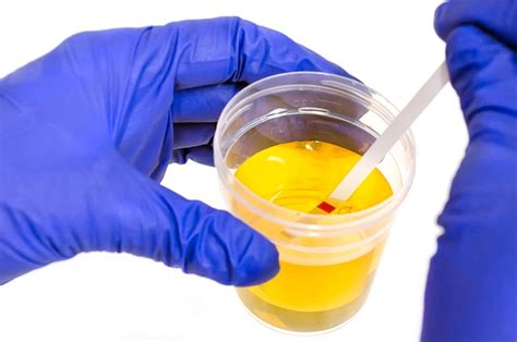 urine test image