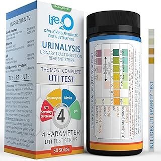 Urine Test Indicators For Uti
