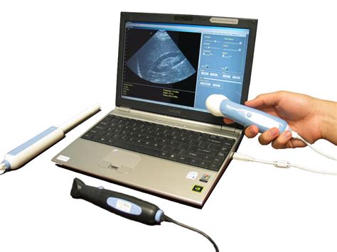 INUCL Portable Ultrasound Machine USB Dual Head Echo Android Ultrasound Probe,USB probe