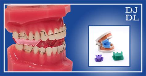 Use Of Bite Block In Dentistry