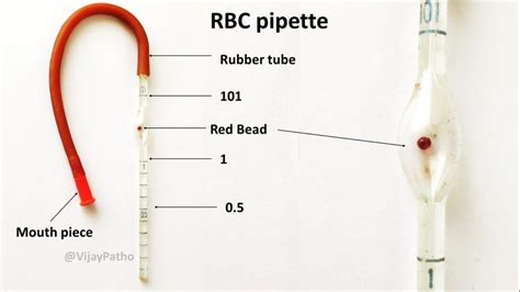 Use Of Hemoglobin Pipette