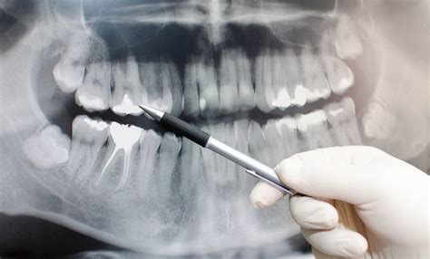 Use Of Oral Radiology