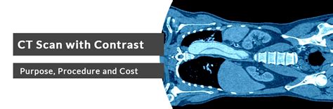 Using Contrast In Ct Scan
