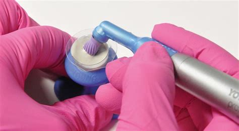 Using Prophy Paste With Electric Toothbrush