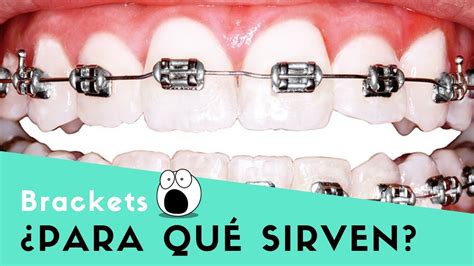 Uso De Brackets En Ingles