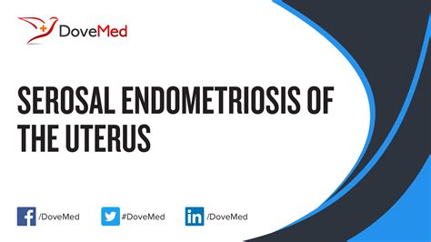 uterine serosa with endometriosis icd 10